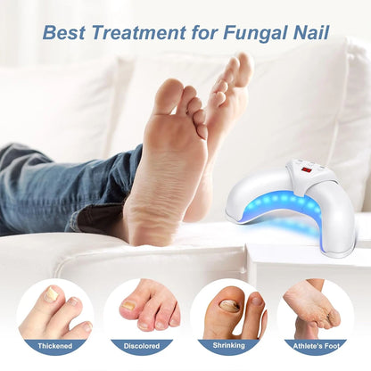 FungalEase Pro Antifungal Laser