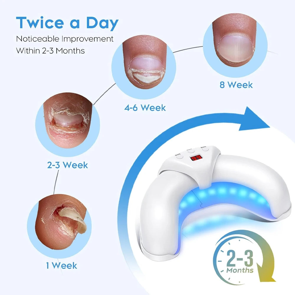 FungalEase Pro Antifungal Laser